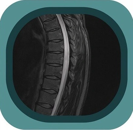 MRI T spine anatomy icon